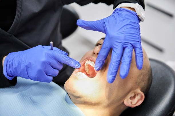 Best Emergency Tooth Extraction in Sulphur Springs, TX